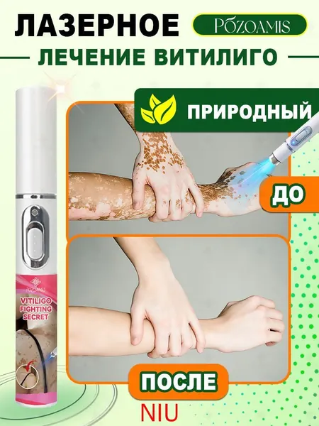 Лазерная ручка, разработанная специально для витилиго, точно осветляет белые пятна и выравнивает тон кожи. Без боли всего один стик поможет вернуть чистой, ровной и сияющей здоровой коже.