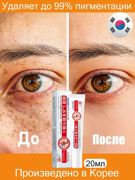 Содержит ниацинамид/Крем от пигментных пятен для лица Корея/20 мл/Содержит активные осветляющие компоненты/Устраняет мелазму, пигментацию, солнечные и тёмные пятна, интенсивно осветляет кожу