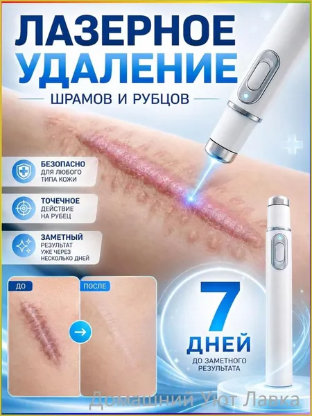 Лазерная ручка для удаления шрамов, удаляет шрамы, родинки, ожоги, растяжки, следы ожирения, лечит послеоперационные шрамы, предотвращает образование рубцов, восстанавливает кожу.1 упаковка.