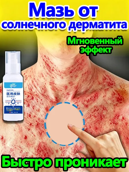 Крем для лечения солнечного дерматита,Восстановление кожи после солнечных ожогов крем после загара