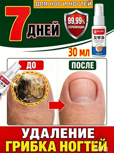 Спрей от грибка ногтей, за 7 дней устраняет грибок, желтизну, утолщение, зуд, запах и ломкость, глубоко очищает пластину, помогает вернуть аккуратный здоровый вид, защита, для рук и ног, 30 мл