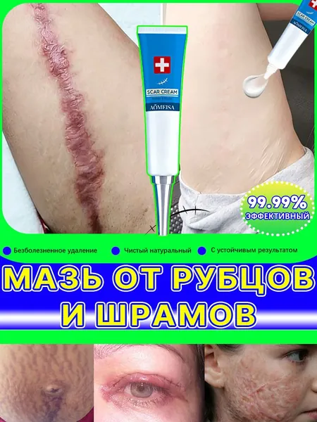 Гель от рубцов: для лечения растяжек, угревой сыпи, ожогов, послеоперационных и келоидных рубцов, 20 мл