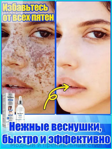 Отбеливающее и от веснушек эфирное масло, осветляет на 7 дней, аккуратно удаляет различные пигментные пятна, восстанавливает после пребывания на солнце, повышает тонус кожи, питает и увлажняет.
