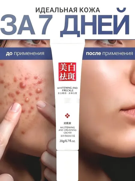 VOIS Крем для лица от воспалений с ниацинамидом,Точечный крем от прыщей,гель для лица от прыщей и черных точек точечный, корректирующий с ниацинамидом и цинком для проблемной кожи,20 г