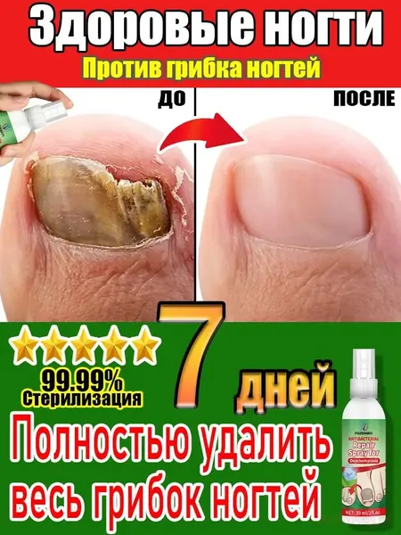 Спрей от грибковых заболеваний, эффективен в течение 7 дней, лечит онихомикоз и трещины на ногтях. Подавляет рост грибков, способствует росту ногтей, устраняет зуд и неприятный запах. 30 мл