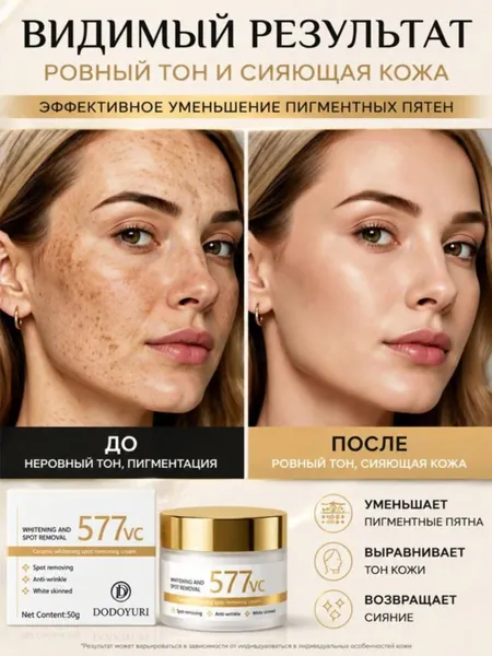 577 Крем для осветления кожи и удаления пигментных пятен эффективно удаляет старческие пятна, веснушки и пигментные пятна, борется с гиперпигментацией и улучшает цвет лица, 50 г