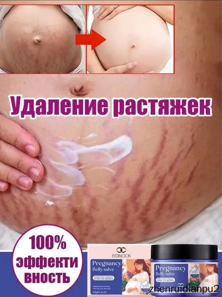 Крем от растяжек для беременных, Быстрое удаление растяжек, пигментации и шрамов,Послеродовые абдоминальные линии,восстанавливает эластичность кожи, подходит для ухода за кожей после родов 120 г.