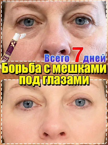 Антивозрастной роликовый крем для глаз, быстро разглаживает мелкие морщины, уменьшает отеки и темные круги под глазами, увлажняет и подтягивает кожу, восстанавливая ее молодость. 90 мл.