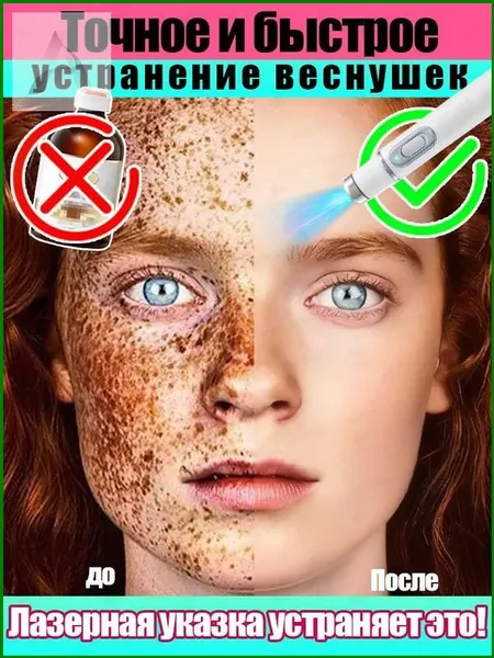 Ручка для удаления веснушек. Эффективно удаляет веснушки, пигментные пятна, солнечные пятна и пигментацию. Новейшие технологии. Восстанавливает кожу и улучшает цвет лица.Два предмета