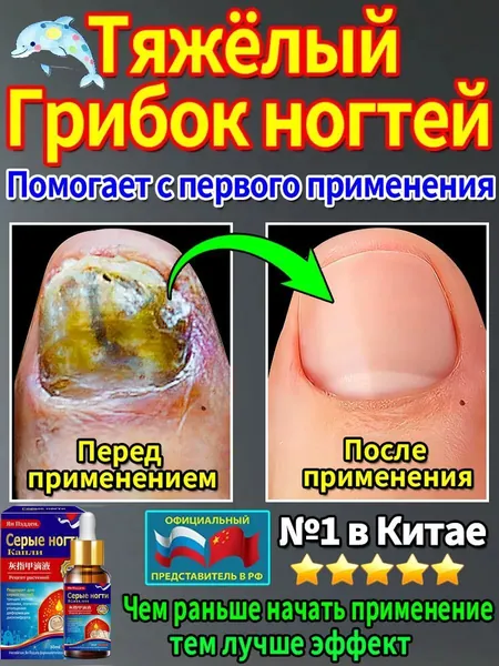 Он подходит для лечения онихомикоза рук и ног, быстрого устранения грибка ногтей, профилактики и лечения онихомикоза и стимуляции роста ногтей.Ингредиенты мягкие и не вызывают раздражения