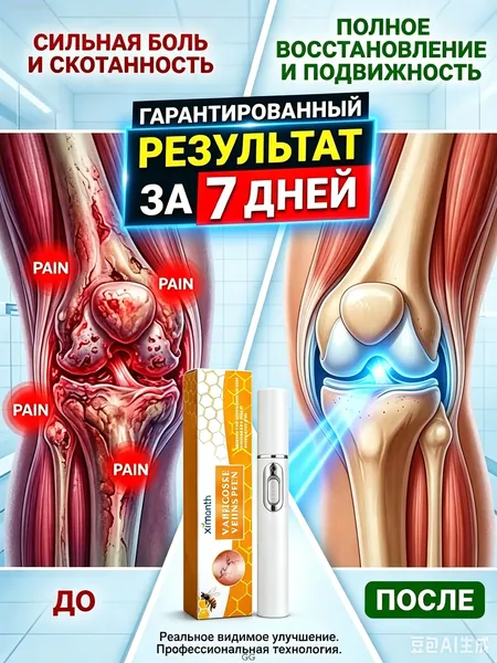 Лазерная указка для снятия боли при артрите и подагре