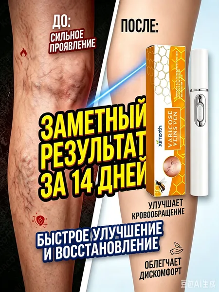Медицинский лазер для удаления варикозного расширения вен. Безболезненное удаление варикозных вен, сосудистых звездочек и тромбов. отёки ног и тяжесть.Улучшает кровообращение. 1 шт.