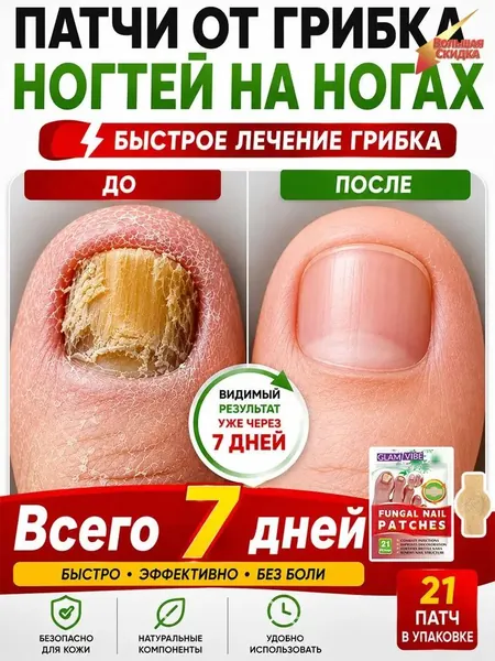 Противогрибковые пластыри для ног, 21 пластырь в упаковке, подходят для лечения онихомикоза и трещин на ногтях ног. Противогрибковое действие. Устраняет онихомикоз и восстанавливает здоровье ногтей
