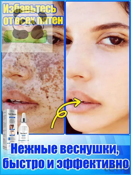 Отбеливающее и от веснушек эфирное масло, осветляет на 7 дней, аккуратно удаляет различные пигментные пятна, восстанавливает после пребывания на солнце, повышает тонус кожи, питает и увлажняет.