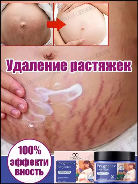 Крем от растяжек для беременных, Быстрое удаление растяжек, пигментации и шрамов,Послеродовые абдоминальные линии,восстанавливает эластичность кожи, подходит для ухода за кожей после родов 120 г.