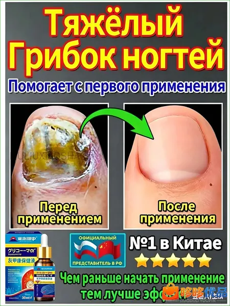 Данным средством, предназначенным для терапии онихомикоза рук и ног, обеспечивается скорейшее устранение грибка ногтевых пластин, а также их профилактика, лечение и стимуляция роста; состав является м
