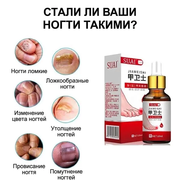 Сильная эссенция для лечения грибка ногтей, удаление грибка ногтей на ногах, 10 мл