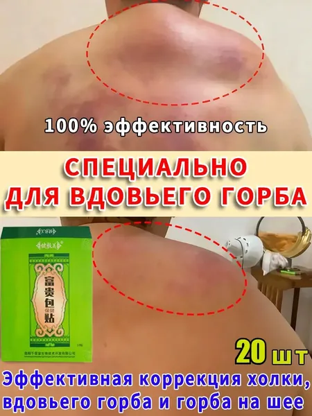 Премиумнабор пластырей для шеи от холки и жировых отложений, 2 упаковки по 10 штук. Дискомфорт снимается, мышечная поддержка обеспечивается. Качественный курс для здоровья спины.
