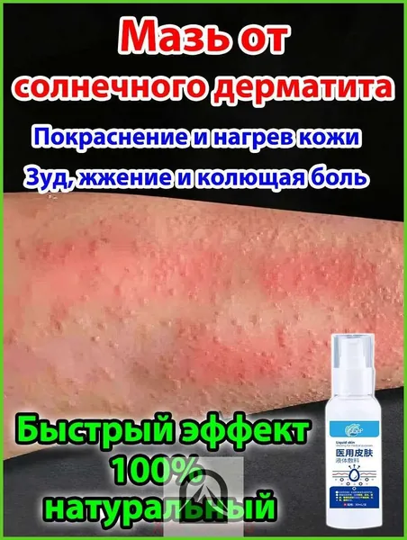 Крем для лечения солнечного дерматита,Восстановление кожи после солнечных ожогов крем после загара