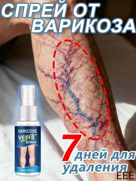 Средство от варикоза с натуральными растительными экстрактами, улучшает циркуляцию крови и снижает отечность ног, 30 мл