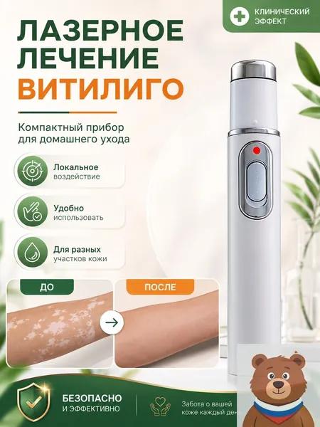 Лазерная ручка, разработанная специально для витилиго, точно осветляет белые пятна и выравнивает тон кожи. Без боли всего один стик поможет вернуть чистой, ровной и сияющей здоровой коже.