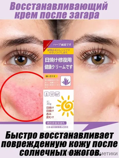 Восстанавливающий крем после загара/Успокаивает покраснения и отеки,Предотвратить пигментацию,Увлажняющий и питательный/30 г