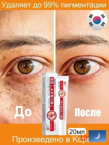 Содержит ниацинамид/Крем от пигментных пятен для лица Корея/20 мл/Содержит активные осветляющие компоненты/Устраняет мелазму, пигментацию, солнечные и тёмные пятна, интенсивно осветляет кожу