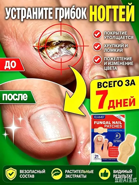 Пластыри от онихомикоза эффективно лечат грибковые инфекции ногтей и паронихию, восстанавливают поврежденные ногти, устраняют пожелтение и ломкость, подходят для рук и ног. 21 штука