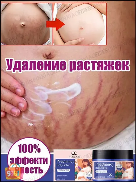Крем от растяжек для беременных, Быстрое удаление растяжек, пигментации и шрамов,Послеродовые абдоминальные линии,восстанавливает эластичность кожи, подходит для ухода за кожей после родов 120 г.