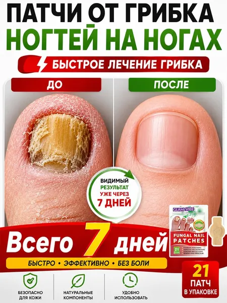 Противогрибковые пластыри для ног, 21 пластырь в упаковке, подходят для лечения онихомикоза и трещин на ногтях ног. Противогрибковое действие. Устраняет онихомикоз и восстанавливает здоровье ногтей