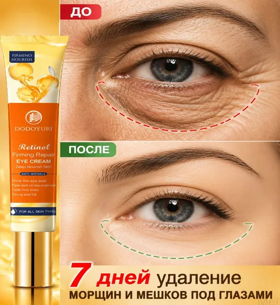 Качественный крем для зоны вокруг глаз 20 г, благодаря которому уменьшаются морщины и тёмные круги, улучшается упругость кожи, а отёчность снижается за счёт лифтингового эффекта.
