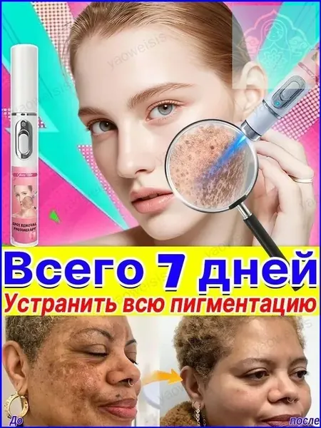 Удаляет пигментные пятна, веснушки, солнечные ожоги, меланодермию, угревую сыпь, морщины.Лазерная указка устраняет пигментацию на лице и теле и отбеливает кожу.1 палочка