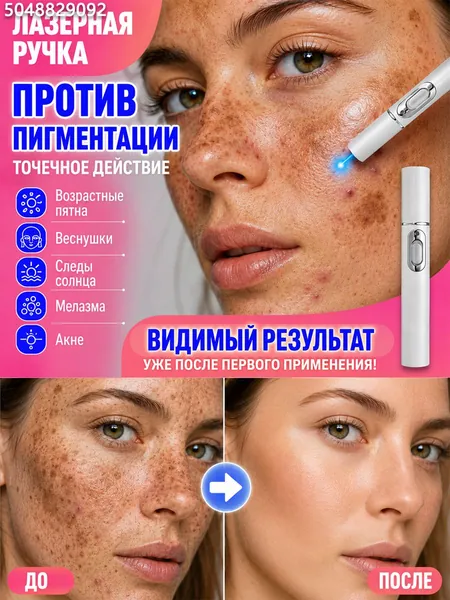 Лазерная ручка от возрастных пигментных пятен и меланодермии, Коррекция веснушек и последствий солнечных ожогов Домашний косметический прибор в дополнение к крему с микроиглами для лица