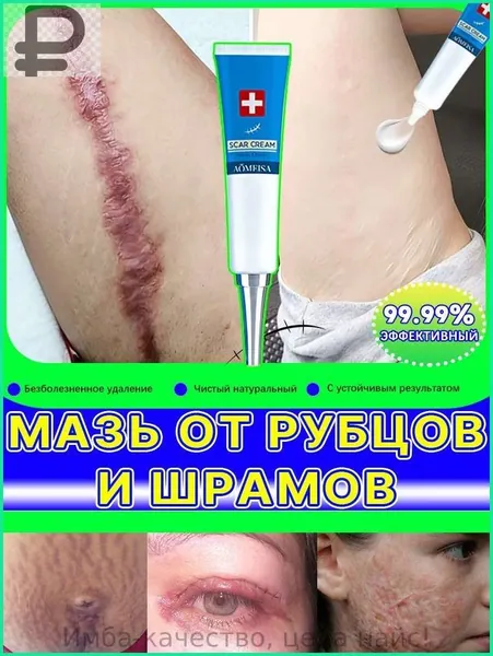 Гель от рубцов: для лечения растяжек, угревой сыпи, ожогов, послеоперационных и келоидных рубцов, 100 мл