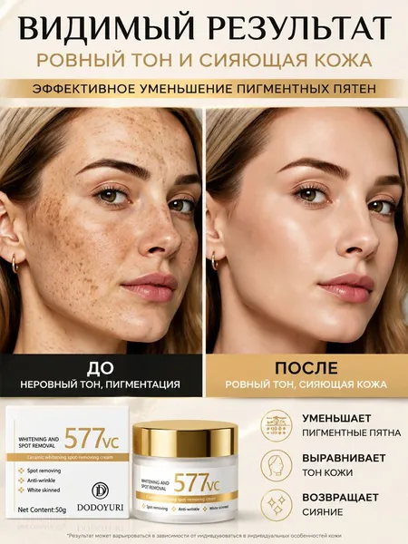 577 Крем для осветления кожи и удаления пигментных пятен эффективно удаляет старческие пятна, веснушки и пигментные пятна, борется с гиперпигментацией и улучшает цвет лица, 50 г