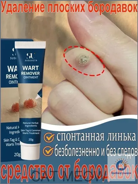 Средство от папиллом и бородавок(Совершенно новая версия ), для удаления бородавок папиллом, сухих мозолей на ногах и теле, мазь для ухода за кожей, безболезненно, не оставляет следов 20 г
