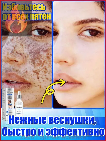 Отбеливающее и от веснушек эфирное масло, осветляет на 7 дней, аккуратно удаляет различные пигментные пятна, восстанавливает после пребывания на солнце, повышает тонус кожи, питает и увлажняет.