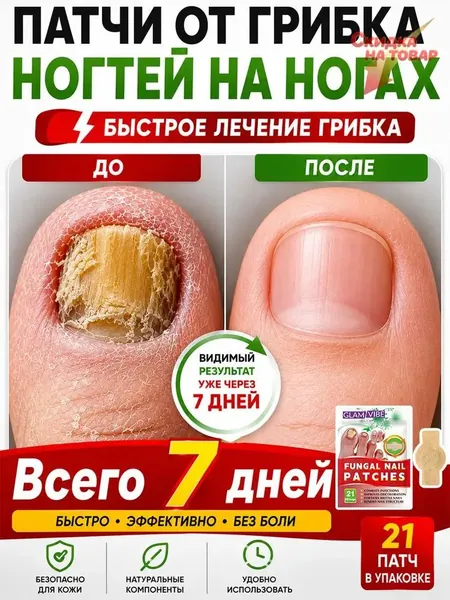 Противогрибковые пластыри для ног, 21 пластырь в упаковке, подходят для лечения онихомикоза и трещин на ногтях ног. Противогрибковое действие. Устраняет онихомикоз и восстанавливает здоровье ногтей