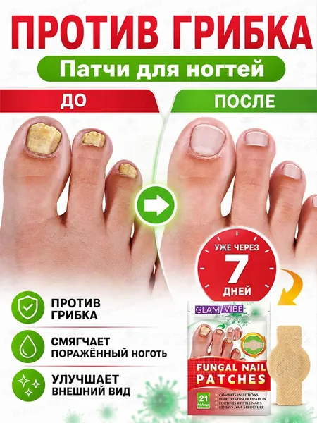 Пластырь для ухода за ногтями от грибка, эффективно смягчает и утолщает желтеющие ногти, подавляет грибковые заболевания, уменьшает рецидивы и способствует здоровому росту ногтевого ложа, 21 штука.