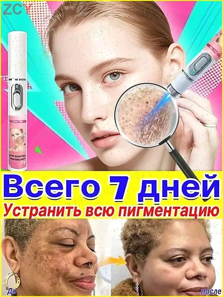 Удаляет пигментные пятна, веснушки, солнечные ожоги, меланодермию, угревую сыпь, морщины.Лазерная указка устраняет пигментацию на лице и теле и отбеливает кожу.1 палочка