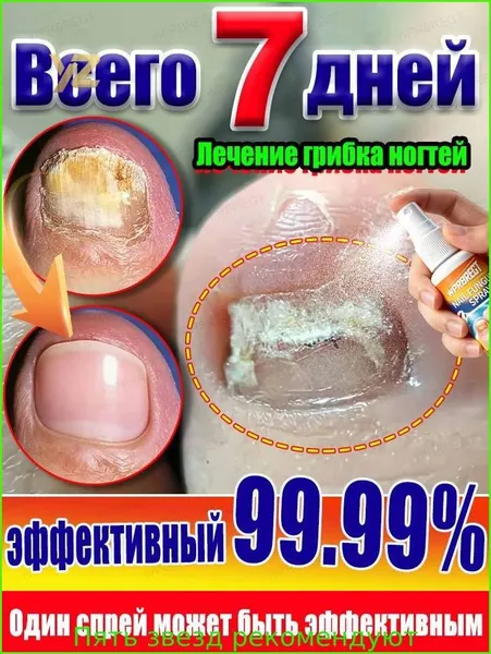Спрей от грибка ногтей антибактериальное и противогрибковое действие, размягчение и восстановление ногтевой пластины. Натуральные экстракты, без гормонов. Устраняет зуд, шелушение и запах. 30 мл