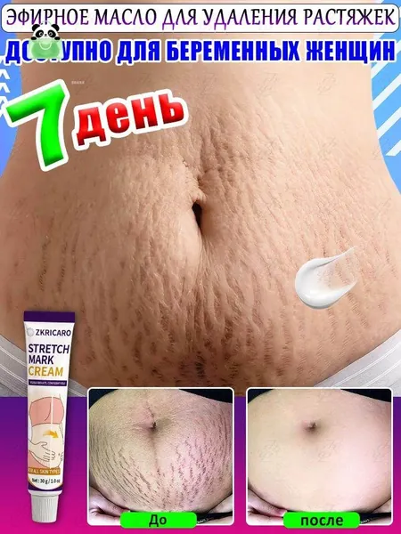 Восстанавливает упругость кожи, для тела, груди, ягодиц, живота росле родов. 30 г крем от растяжек для беременных Удаляет растяжки, восстанавливает упругость кожи, подходит для тела, груди и бедер