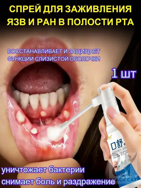 Спрей для заживления ран в полости рта Mouth Ulcer / Снимает боль и раздражение, Уничтожает бактерии, Восстанавлив