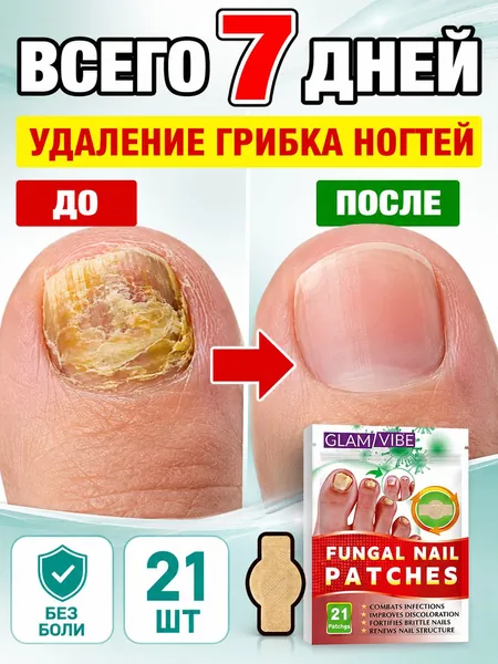 Пластыри для лечения и дезинфекции ногтей на ногах подавляют грибок, лечат паронихию и онихомикоз, утолщают ногти и способствуют их росту, а также снимают зуд. В наличии 21 пластырь.