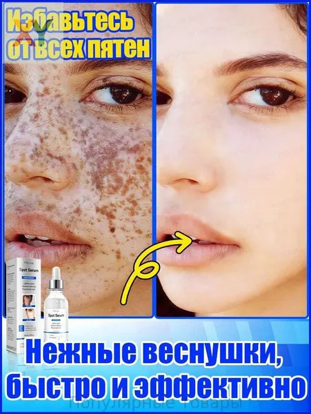 Отбеливающее и от веснушек эфирное масло, осветляет на 7 дней, аккуратно удаляет различные пигментные пятна, восстанавливает после пребывания на солнце, повышает тонус кожи, питает и увлажняет.