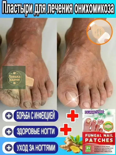 Противогрибковые пластыри для ногтей и кутикулы,Используемый для лечения грибковых инфекций и онихолизиса, он обладает противогрибковыми свойствами и способствует росту и укреплению ногтей.