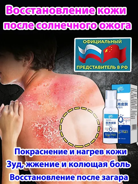 Крем для лечения солнечного дерматита,Восстановление кожи после солнечных ожогов крем после загара