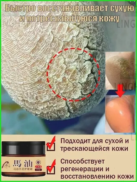 Восстанавливающий крем для ног с лошадиным жиром, заживляет трещины на пятках, предотвращает зуд, омозолелости, повреждения и шелушение, облегчает боль, подходит для сухой и грубой кожи, 35 г.