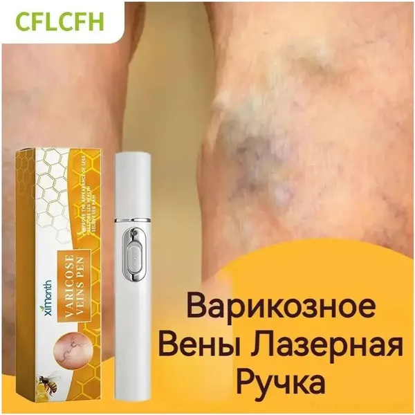 Качественный аппарат для лечения венозной недостаточности, используемый при восстановлении сосудистой системы ног, которым устраняется боль и припухлость, а также стимулируется кровоток.