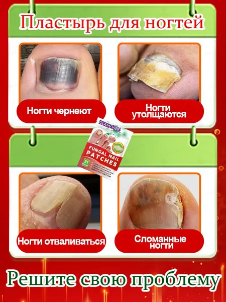 Универсальный пластырь от грибка ногтей, мощное противогрибковое средство, смягчает и утолщает ногтевое ложе, восстанавливает поврежденные ногти ,Оживите и восстановите ваши ногти.21 штука .